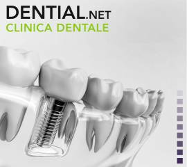 Centro implantologia dentale in Albania o Croazia?