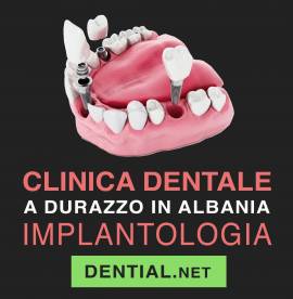 Centro implantologia dentale in Albania o Croazia?