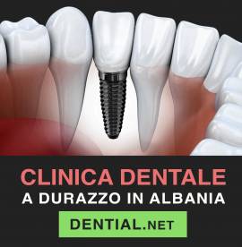 Centro implantologia dentale in Albania o Croazia?