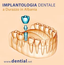 Come scegliere la migliore clinica dentale Albania