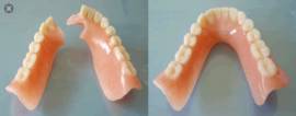 Odontotecnico Riparazioni Protesi Dentali 1ora Bologna