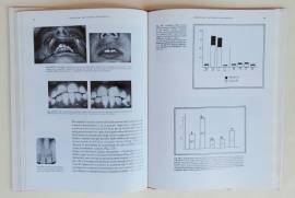 Vademecum di Ortognatodonzia.Prevenzione delle malocclusione Testo Atlante Giuliano Albini Riccioli 